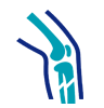Joint Replacement